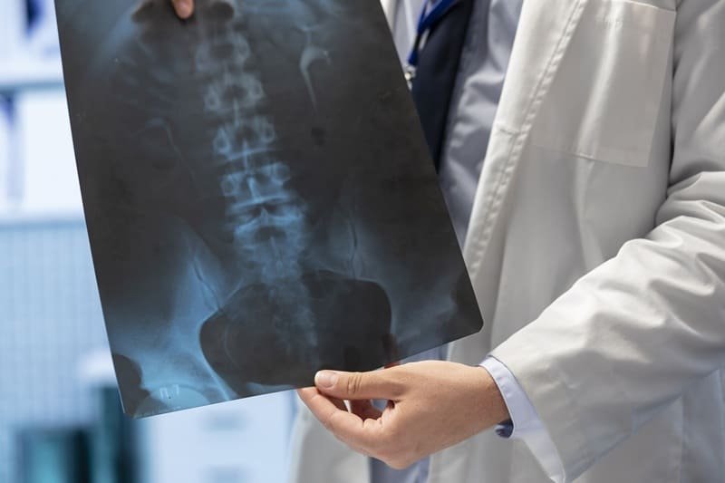 Radiografía de abdomen