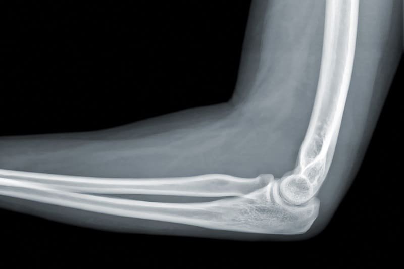 Radiografía de codo en Guadalajara, Jalisco