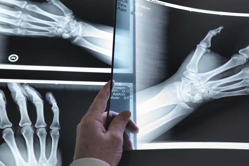 Radiografía de muñeca en Guadalajara, Jalisco