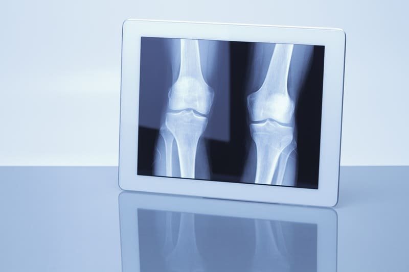 Radiografía de rodilla en Guadalajara, Jalisco