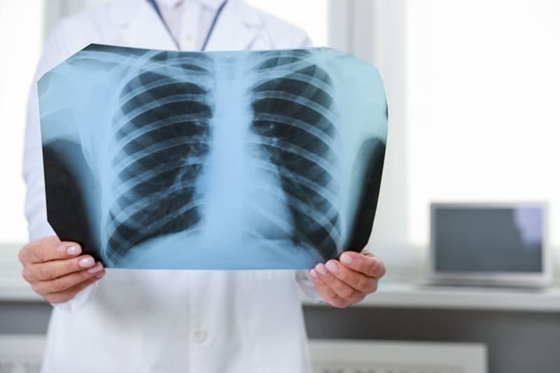 Radiografía de tórax